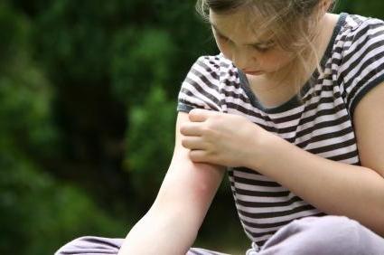 След това да обработвате ухапване от комар на детето - важно е да знаете!