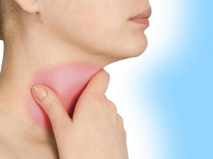 Стрептококи в гърлото: признаци, причини и лечение