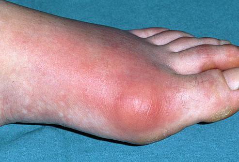 Болести на краката: имена, симптоми и методи на лечение